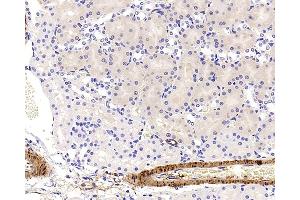 Immunohistochemistry analysis of paraffin-embedded Rat kidney using TAGLN Polyclonal Antibody at dilution of 1:400. (Transgelin antibody)