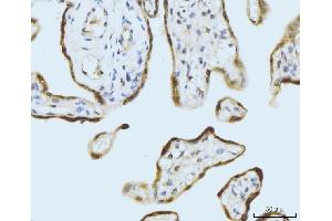 IHC analysis of SBNO1 using anti-SBNO1 antibody (ABIN7601710).
