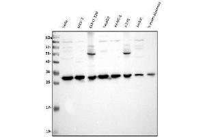 Western blot analysis of VAPB using anti-VAPB antibody (ABIN5693292). (VAPB antibody  (AA 2-55))