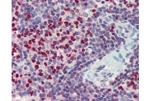 FCHO1 antibody was used for immunohistochemistry at a concentration of 4-8 ug/ml. (FCHO1 antibody  (Middle Region))