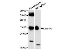 Western blot analysis of extracts of various cell lines, using GIMAP5 antibody (ABIN5996705) at 1:3000 dilution. (GIMAP5 antibody)
