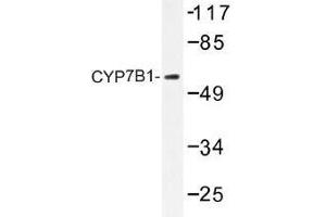 Image no. 1 for anti-Cytochrome P450, Family 7, Subfamily B, Polypeptide 1 (CYP7B1) antibody (ABIN317809)