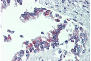 Immunohistochemistry (Formalin-fixed Paraffin-embedded Sections) (IHC (fp)) image for anti-BCL2-Antagonist/killer 1 (BAK1) (AA 1-14) antibody (ABIN573998)