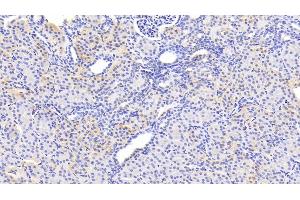 Detection of SERPINB3 in Human Kidney Tissue using Polyclonal Antibody to Serpin B3 (SERPINB3) (SERPINB3 antibody  (AA 1-210))