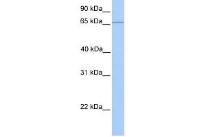 WB Suggested Anti-CLCNKA Antibody Titration:  0. (CLCNKA antibody  (N-Term))