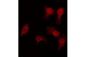 ABIN6272458 staining HuvEc by IF/ICC. (Vomeronasal 1 Receptor 3 (VMN1R3) antibody)