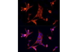 Immunofluorescence analysis of NIH/3T3 cells using MTAP Rabbit mAb (ABIN7268498) at dilution of 1:100 (40x lens). (MTAP antibody)