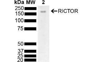 Western blot analysis of Mouse Brain showing detection of 192 kDa RICTOR protein using Rabbit Anti-RICTOR Polyclonal Antibody (ABIN5696207). (RICTOR antibody  (AA 1060-1160) (PE))