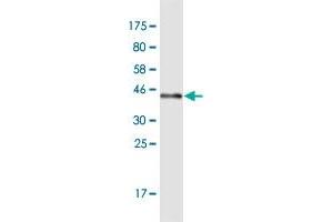 Western Blot detection against Immunogen (41. (SLC22A18AS antibody  (AA 1-150))
