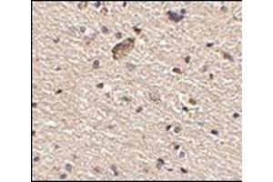 Immunohistochemistry of Spred1 in human brain tissue with this product at 2. (SPRED1 antibody  (Center))