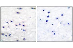 Immunohistochemical analysis of paraffin-embedded human brain tissue using Tyrosine Hydroxylase (epitope around residue 19) antibody (ABIN5976157). (Tyrosine Hydroxylase antibody  (Ser19))