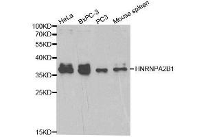 Western Blotting (WB) image for anti-Heterogeneous Nuclear Ribonucleoprotein A2/B1 (HNRNPA2B1) (AA 1-180) antibody (ABIN3021593)