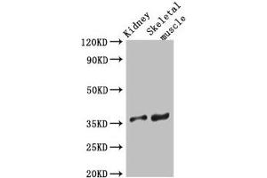 Western Blot Positive WB detected in: Mouse kidney tissue, Mouse skeletal muscle tissue All lanes: SLC25A32 antibody at 3 μg/mL Secondary Goat polyclonal to rabbit IgG at 1/50000 dilution Predicted band size: 36 kDa Observed band size: 36 kDa (SLC25A32 antibody  (AA 44-88))