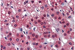 Human Adrenal: Formalin-Fixed, Paraffin-Embedded (FFPE) (Calcyphosine 2 antibody  (Internal Region))