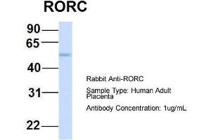 Host:  Rabbit  Target Name:  RORC  Sample Type:  Human Adult Placenta  Antibody Dilution:  1. (RORC antibody  (Middle Region))