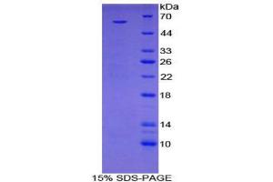 SDS-PAGE (SDS) image for H2A Histone Family, Member Y (H2AFY) (AA 109-369) protein (His tag,GST tag) (ABIN2122951) (H2AFY Protein (AA 109-369) (His tag,GST tag))