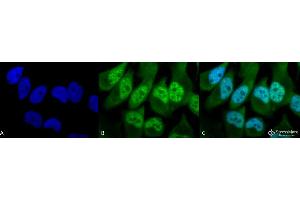 Immunocytochemistry/Immunofluorescence analysis using Rabbit Anti-Phosphothreonine Polyclonal Antibody . (Phosphothreonine antibody  (FITC))