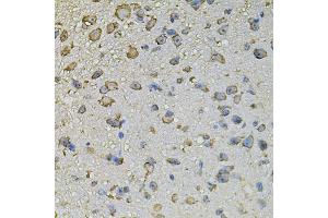 Immunohistochemistry of paraffin-embedded mouse brain using CREBBP antibody (ABIN5974440) at dilution of 1/100 (40x lens). (CBP antibody)