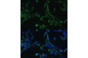 Immunofluorescence analysis of NIH-3T3 cells using eEF1G Polyclonal Antibody (ABIN6133514, ABIN6139951, ABIN6139952 and ABIN6223877) at dilution of 1:100 (40x lens). (EEF1G antibody  (AA 168-437))