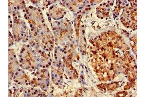 Immunohistochemistry of paraffin-embedded human pancreatic tissue using ABIN7144793 at dilution of 1:100 (Ataxin 3 antibody  (AA 1-288))