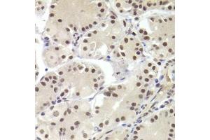 Immunohistochemistry of paraffin-embedded human stomach using RBPJ Antibody (ABIN1876876) at dilution of 1:100 (40x lens). (RBPJ antibody)