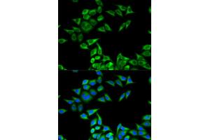 Immunofluorescence analysis of MCF-7 cells using CHMP2B antibody. (CHMP2B antibody)
