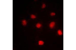 Immunofluorescent analysis of Histone H4 (AcK5) staining in HeLa cells. (Histone H4 antibody  (acLys5, N-Term))