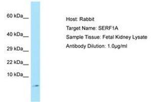 Image no. 1 for anti-Small EDRK-Rich Factor 1A (Telomeric) (SERF1A) (C-Term) antibody (ABIN6750135) (SERF1A antibody  (C-Term))