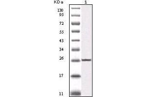 Western blot analysis using IKBKB mouse mAb against truncated IKBKB recombinant protein (1). (IKBKB antibody)