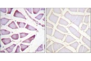 Immunohistochemistry analysis of paraffin-embedded human skeletal muscle tissue, using S6 Ribosomal Protein (Ab-240) Antibody. (RPS6 antibody  (AA 191-240))