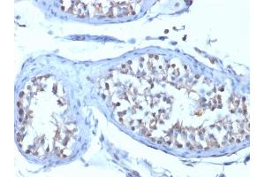 Formalin-fixed, paraffin-embedded human Testicular Carcinoma stained with B7-H4 Mouse Monoclonal Antibody (B7H4/1788). (VTCN1 antibody)