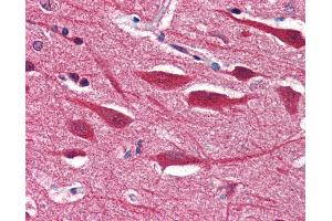 Anti-STX2 / Syntaxin 2 antibody IHC of human brain, cortex.