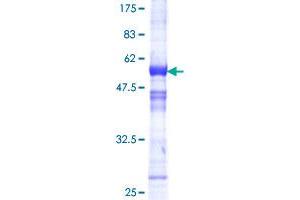RCAN1 Protein (AA 1-197) (GST tag)