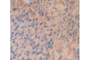 #VALUE! (INSRR antibody  (AA 1067-1296))