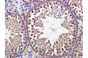 Paraformaldehyde-fixed, paraffin embedded rat testis, Antigen retrieval by boiling in sodium citrate buffer (pH6. (ATG16L1 antibody  (AA 501-607))