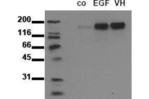 Western Blotting (WB) image for anti-Epidermal Growth Factor Receptor (EGFR) (pTyr1092) antibody (ABIN126770) (EGFR antibody  (pTyr1092))