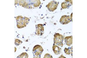 Immunohistochemistry of paraffin-embedded human stomach using TUBB8 antibody. (Tubulin, beta 8 antibody)