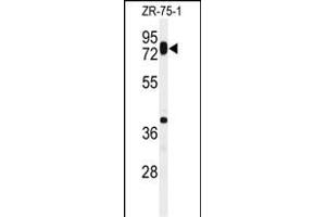 Western blot analysis of HAS1 Antibody (Center) (ABIN651121 and ABIN2840084) in ZR-75-1 cell line lysates (35 μg/lane). (HAS1 antibody  (AA 166-193))