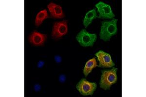 ABIN6262587 and ABIN6273127 staining Hela cells by IF/ICC.