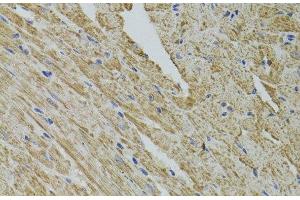 Immunohistochemistry of paraffin-embedded Mouse heart using FHIT Polyclonal Antibody at dilution of 1:100 (40x lens). (FHIT antibody)