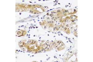 Immunohistochemistry of paraffin-embedded human stomach using NPPA antibody (ABIN5970781) at dilution of 1/200 (40x lens). (NPPA antibody)