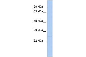 WB Suggested Anti-TNFRSF10C Antibody Titration:  0.