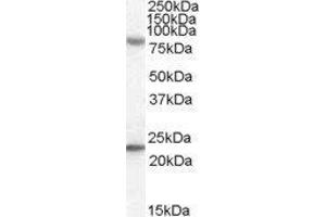 Western Blotting (WB) image for DEXH (Asp-Glu-X-His) Box Polypeptide 58 (DHX58) peptide (ABIN370077) (DEXH (Asp-Glu-X-His) Box Polypeptide 58 (DHX58) Peptide)