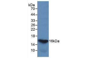 Detection of Recombinant GAL2, Human using Monoclonal Antibody to Galectin 2 (GAL2) (Galectin 2 antibody  (AA 1-132))