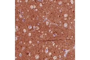 Immunohistochemical staining (Formalin-fixed paraffin-embedded sections) of human cerebral cortex with TSPAN7 monoclonal antibody, clone CL0262  shows strong immunoreactivity in the neuropil. (Tetraspanin 7 antibody)