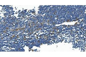 IHC analysis of IL2 Receptor beta/p75/IL2RB using anti-IL2 Receptor beta/p75/IL2RB antibody (ABIN7600988).