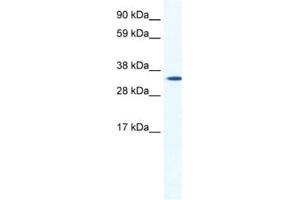 Western Blotting (WB) image for anti-Homeobox B1 (HOXB1) antibody (ABIN2461437) (HOXB1 antibody)