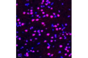 Immunofluorescence of paraffin embedded rat brain using rap1 (ABIN7075857) at dilution of 1: 2000 (400x lens) (RAP1 antibody)
