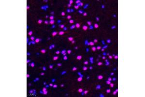 Immunofluorescence of paraffin embedded rat brain using rap1 (ABIN7075857) at dilution of 1: 2000 (400x lens) (RAP1 antibody)