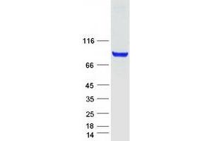 Validation with Western Blot (F13A1 Protein (Myc-DYKDDDDK Tag))